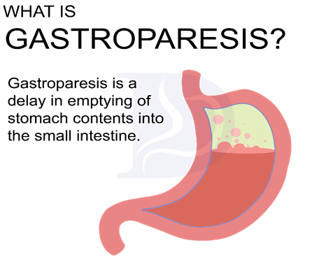 Gastroparesis Diet Image 2