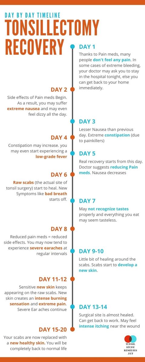 Children's Diet After Tonsillectomy