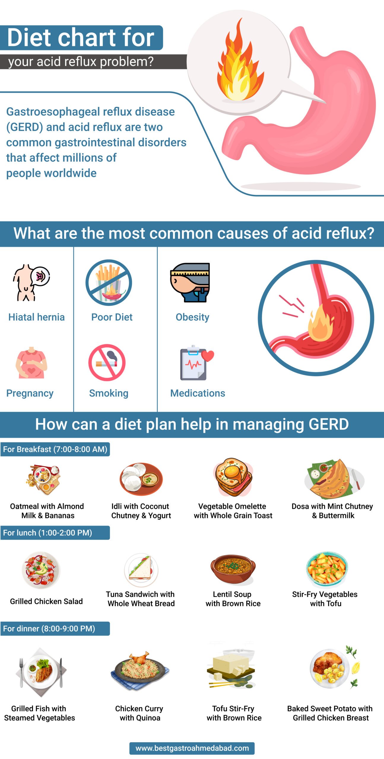 Effective Ways to Optimize Your Gerd Diet Plan for Better Health in 2025